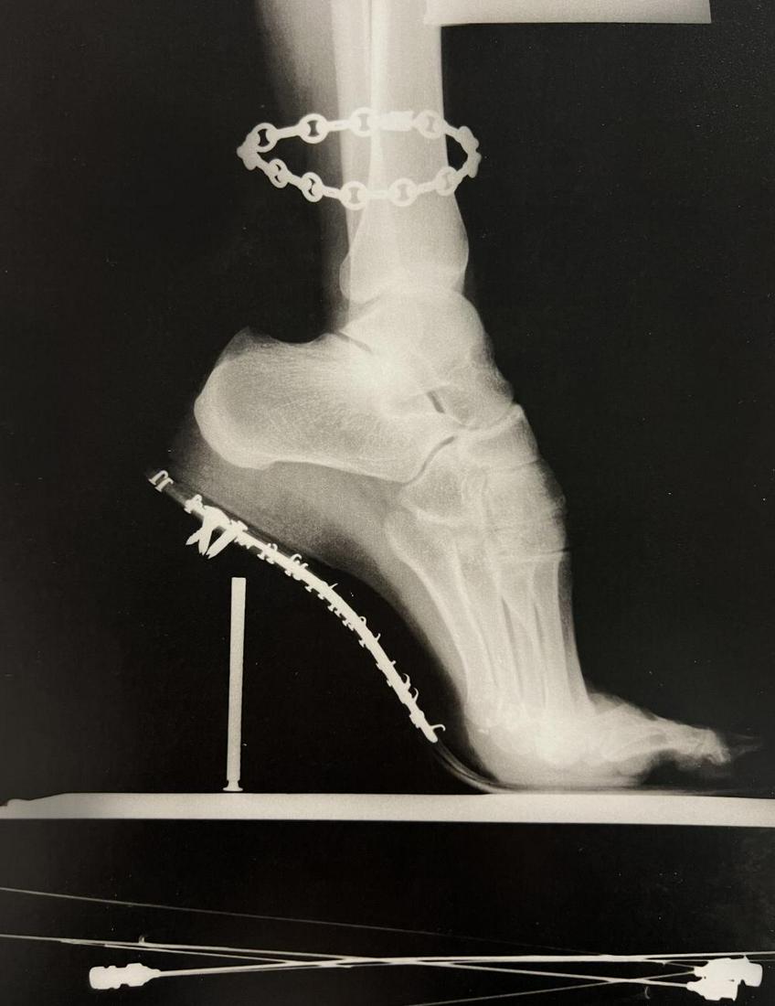 Helmut Newton, X-Ray, French Vogue, Paris, 1994: Photographer: Helmut Newton (Germany, 1920 - 2004) - best known for his erotically charged highly stylized images, Helmut Newton was one of the most influential fashion photographers of all time. Titl