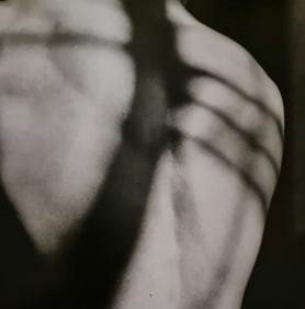 Robert Mapplethorpe, Vibert's Back, 1984 - 1