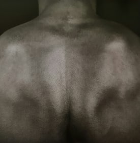 Robert Mapplethorpe, Back, 1987