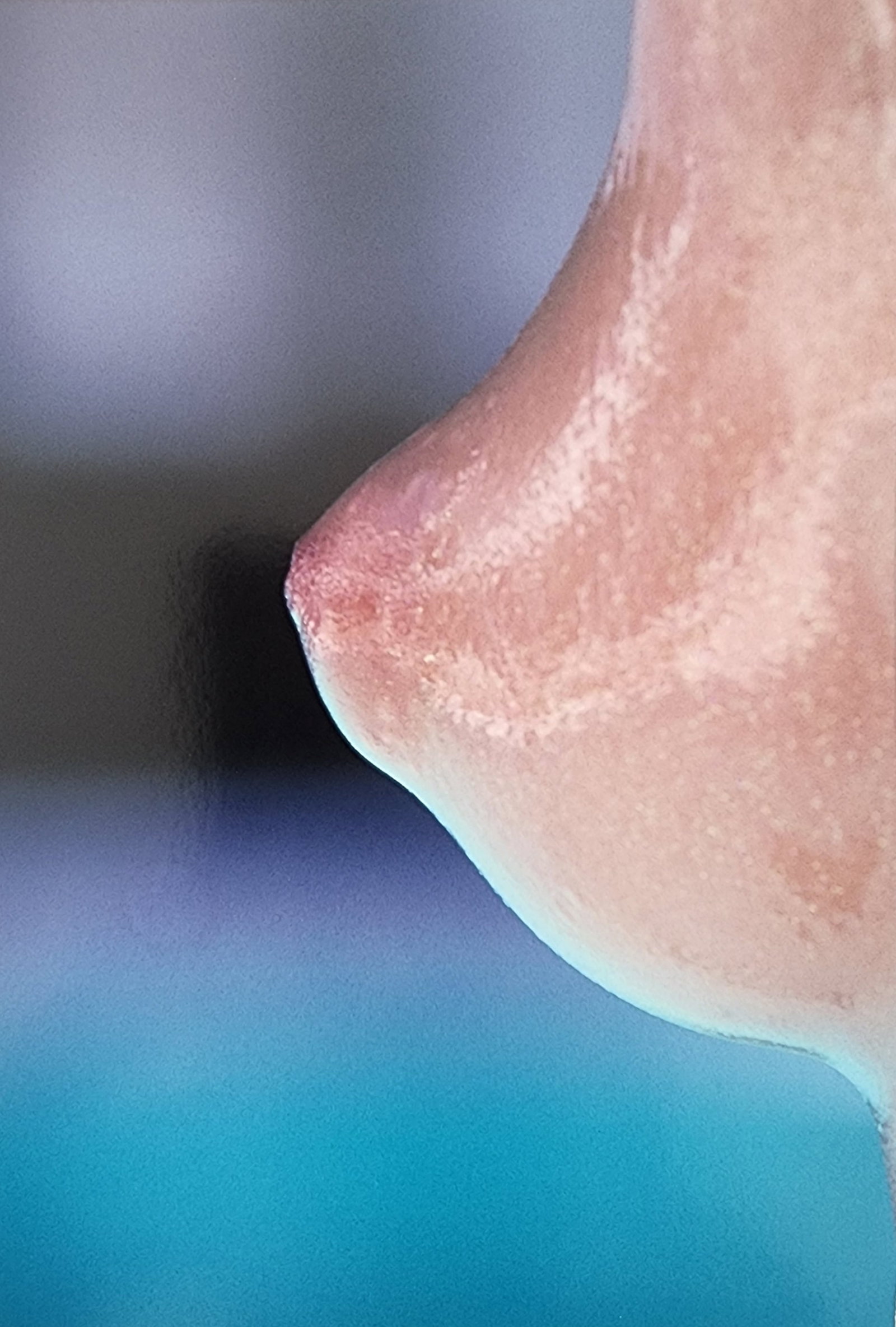 Kishin Shinoyama 'Ami Accidents, 2000: Model/Photographer: Kishin Shinoyama Title/Subject: Ami Accidents Type Of Print: Authentic Sheet Fed Photogravure/Heliogravure. Date Of Print: Japan Paper: Medium weight, satin/matte finish. Print Ori