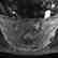 (6) Fingerbowls & Underplates, Rock Crystal, Medallion - 3