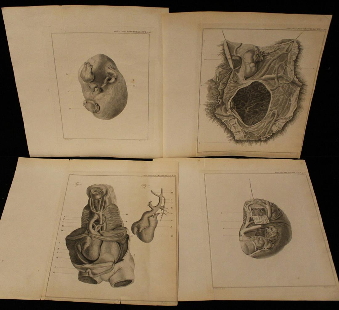 Philosophical Transactions Medical Etchings: Group of 4 late 18th/ early 19th century medical etchings from Philosophical Transactions of the Royal Society of London. (1) Cross section of internal organs. MDCCXCVIII Tab. XVIII p. 356. 10.25 x 11
