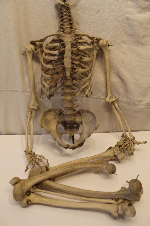 Antique Articulated Human Skeleton Without Skull: Antique medical school articulated human skeleton without matching skull. In good vintage condition with arm bones loose at shoulders; medal rod for original skull still attached to spinal column.