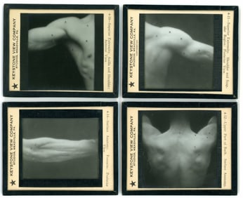 Medical Anatomy Magic Lantern Slides Keystone