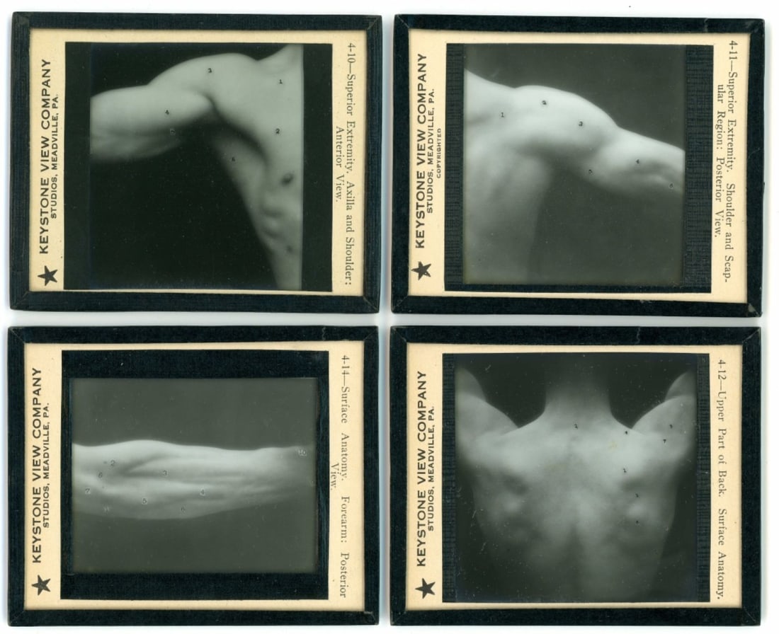 Medical Anatomy Magic Lantern Slides Keystone (1 of 9)