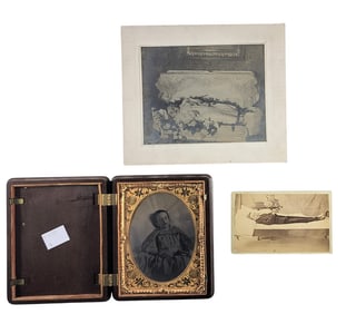 THREE PHOTOGRAPHS OF SICK AND DECEASED CHILDREN