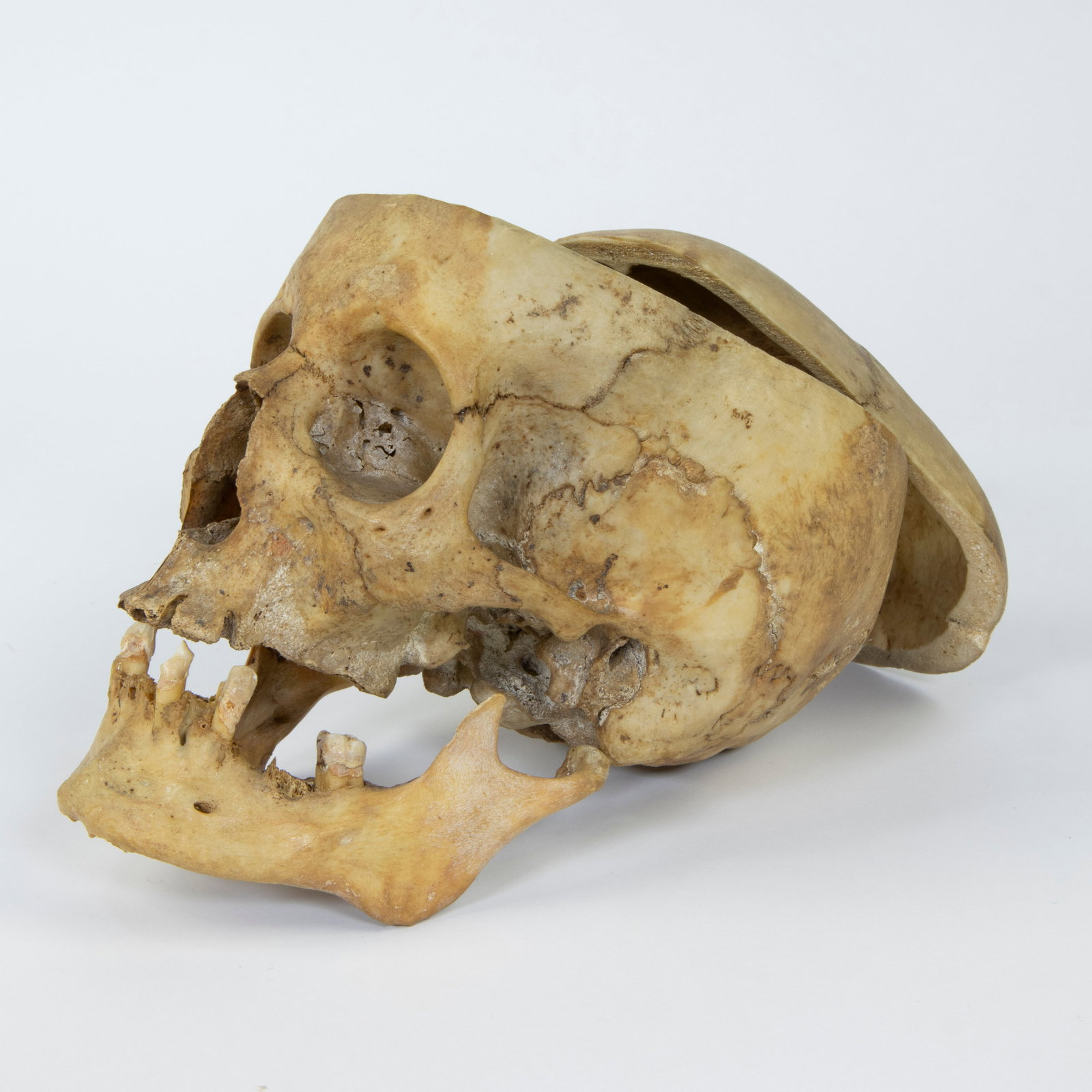 Study skull from doctor's office (1 of 5)