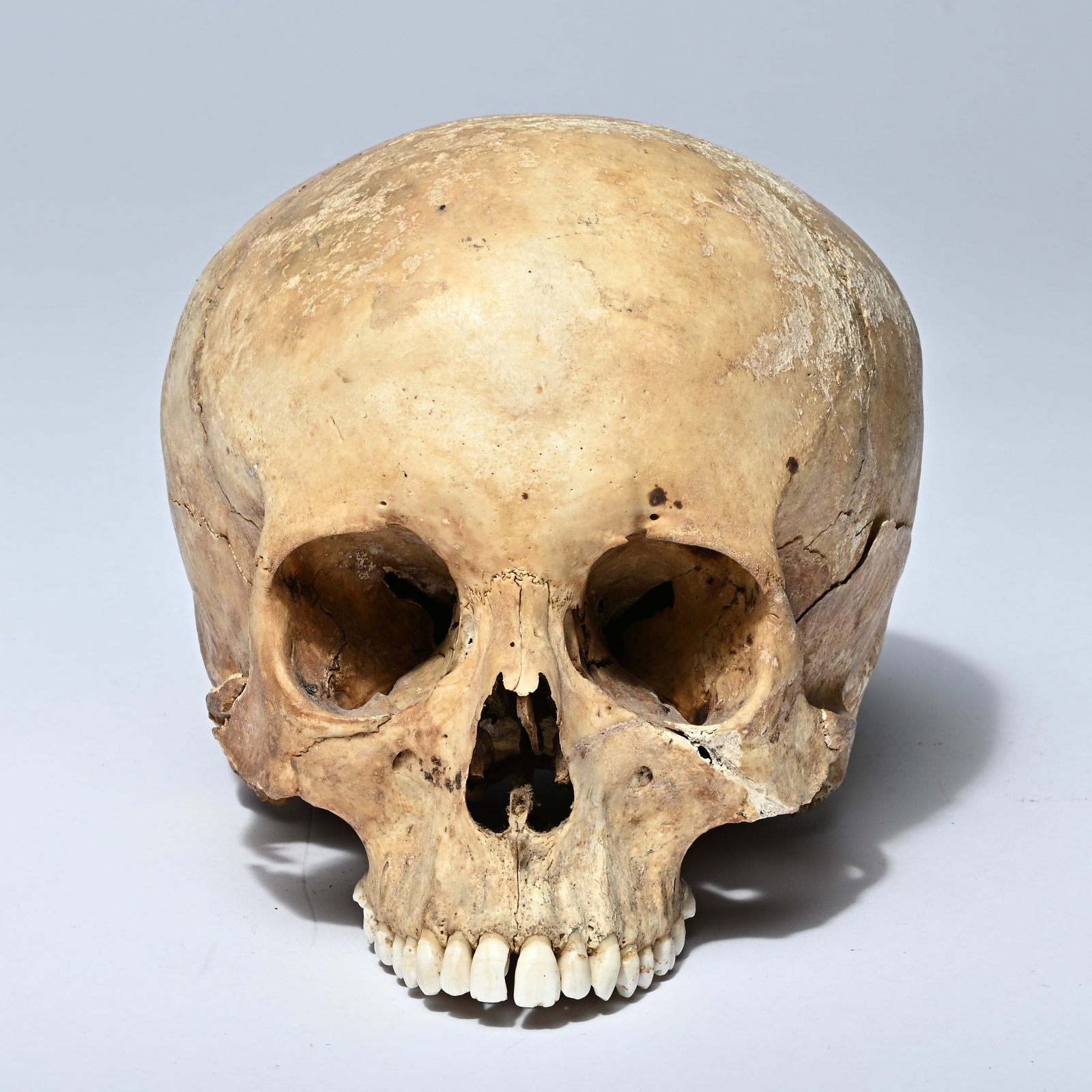 A human skull from a doctor's office (1 of 7)