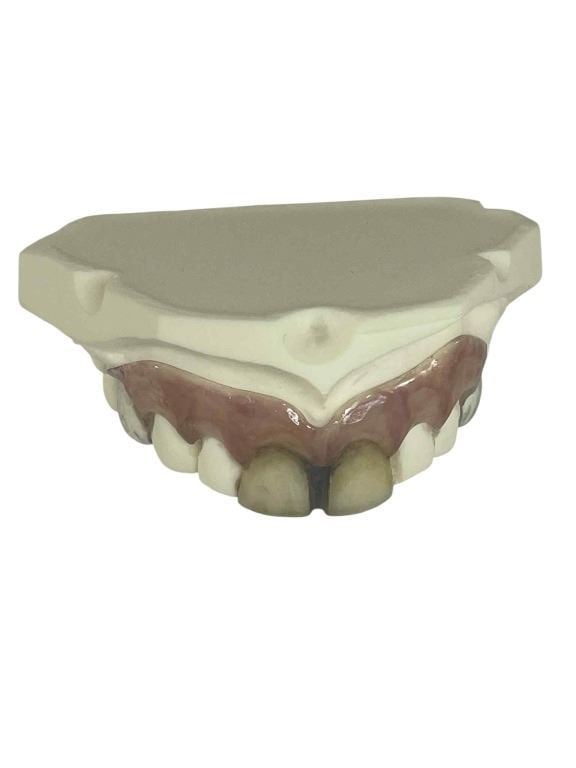 Alice in Wonderland (2010) - The Mad Hatter (Johnny Depp) Teeth Appliance: Alice in Wonderland (2010) - The Mad Hatter (Johnny Depp) Teeth Appliance.Original top teeth appliance for "The Mad Hatter", played by Johnny Depp on the production of the Tim Burton directed fantasy