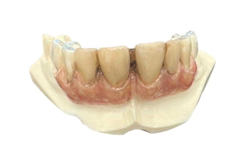 Mortdecai (2015) - Mortdecai (Johnny Depp) Teeth Appliance On Dental Cast: Mortdecai (2015) - Mortdecai (Johnny Depp) Teeth Appliance On Dental Cast.Original teeth appliance and dental cast for Johnny Depp's character as Mortdecai, used in the production of the David Koepp a