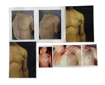 Smallville (2001-2011) - Clark Kent (Tom Welling) Make-up Continuity Shots