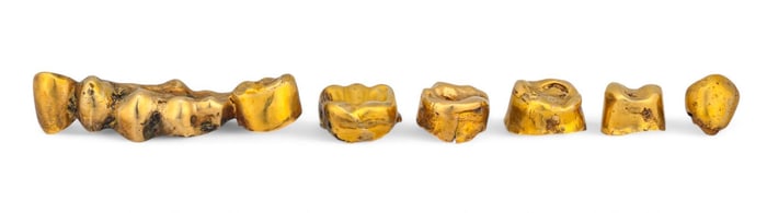 Set of Gold Teeth