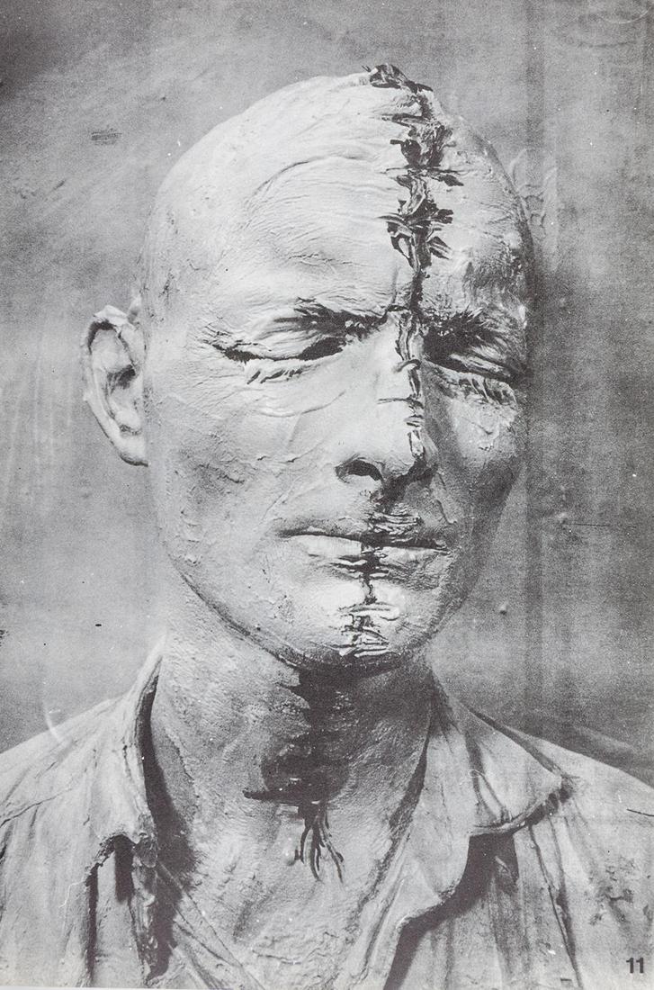 Wiener Aktionismus Brus, Günter Die Schastrommel: Die Schastrommel Nr. 08. Herausgegeben von Günter Brus. Mit Original-Siebdrucken (inklusive Umschlagillustration) sowie zahlreichen Texten, Photos und Zeichnungen der beteiligten Autoren und K