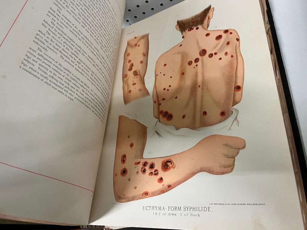 1889 Venereal & Skin Diseases book: 1889 Venereal & Skin Diseases book by Robert W. Taylor. Approx. 18 x 14 x 3 inches.