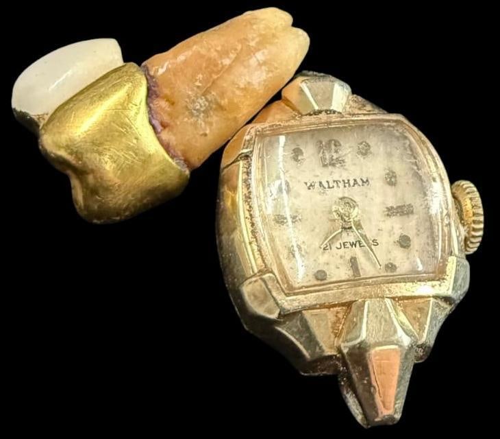 14k Gold Watch and Tooth: 14k Gold Watch and Tooth. 2 pieces. Total weight approx. 12.3 grams.
