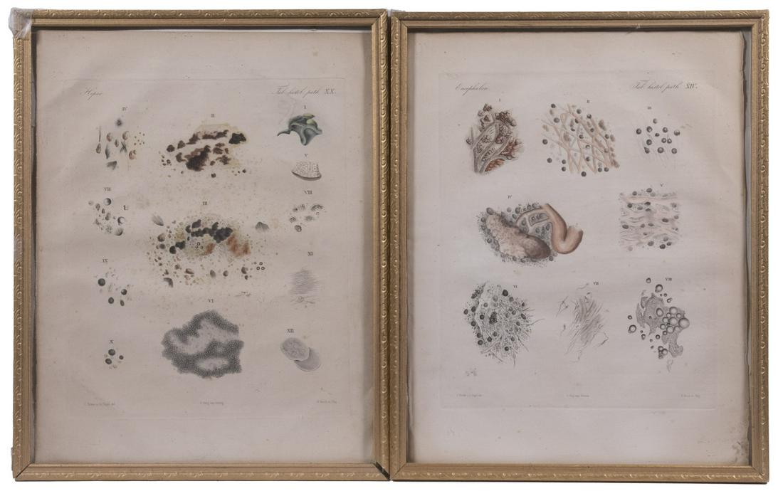 (2) EARLY GERMAN MEDICAL PLATES, HANDCOLORED LITHOS, FRAMED (1 of 4)