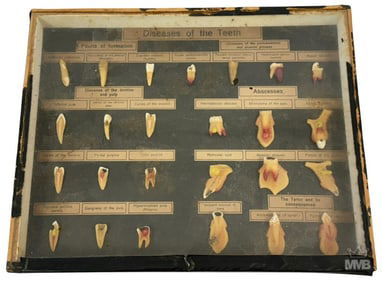 Medical Dentistry Diseases of Teeth Wax Aid Model