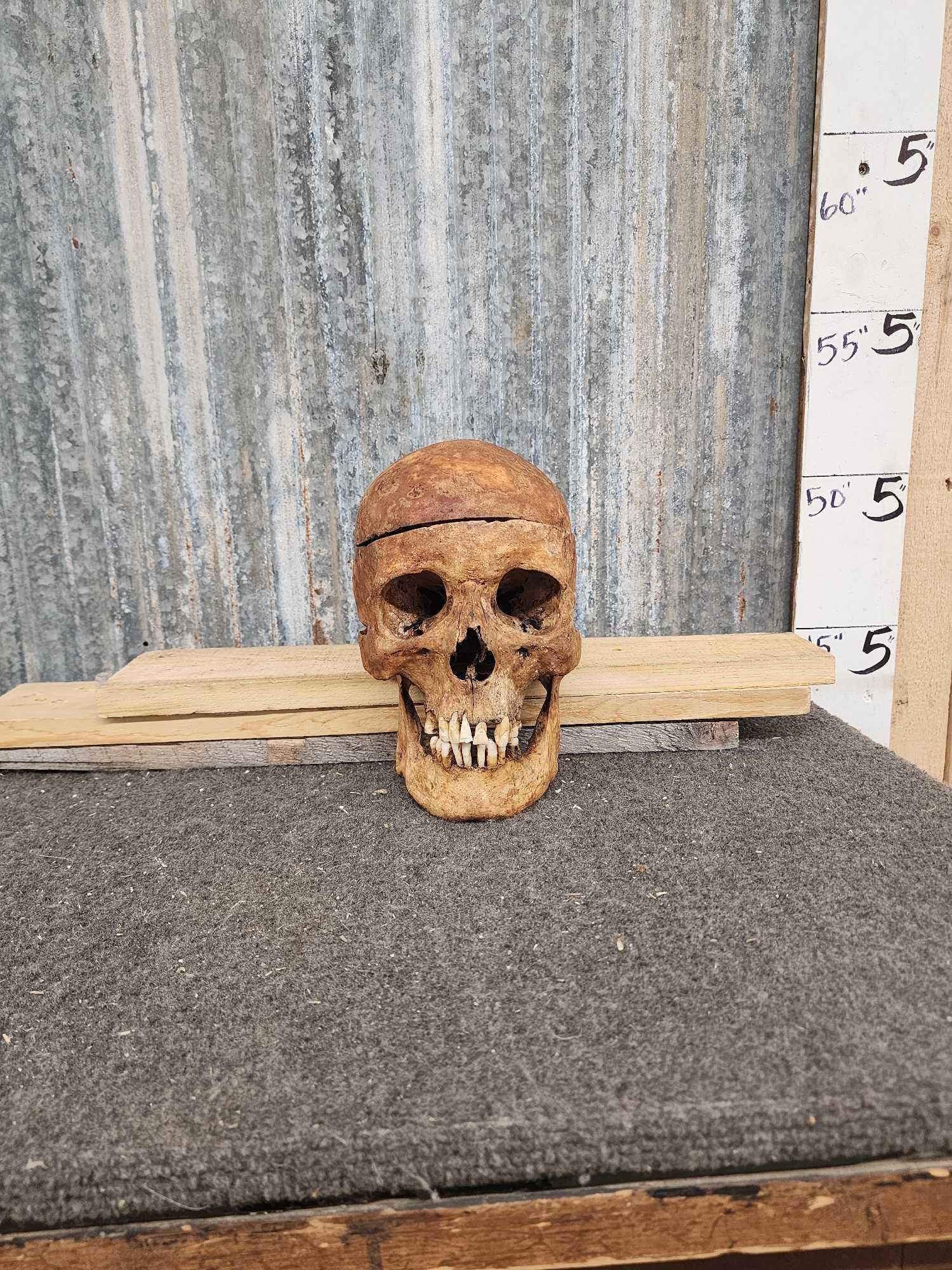 Real Authentic Human Skull (1 of 6)