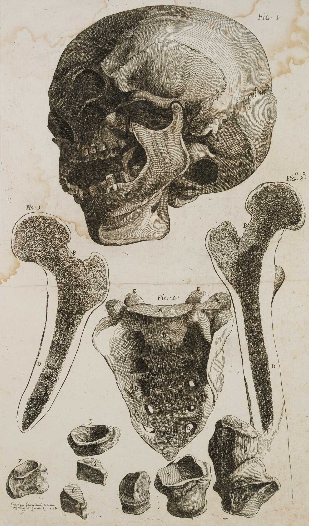 J. LAVALLÉE (19th) after GAMELIN (*1738), Anatomical studies of the skeleton, 1778, Copper (1 of 4)