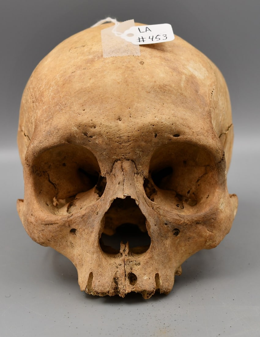 Human Skull: Human skull with no lower jaw bone. (NOTE-Weight and dimensions are before packaging) Weight- 1lb 5.2oz