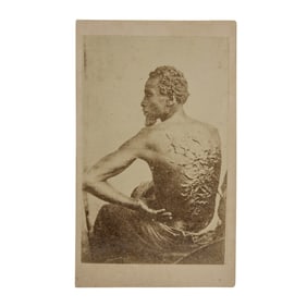 [SLAVERY] The Scourged Back