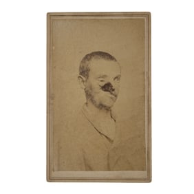 [CIVIL WAR] Soldier w/ Gruesome Facial Wound CDV