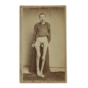 [CIVIL WAR] Veteran's Medical CDV by William Bell