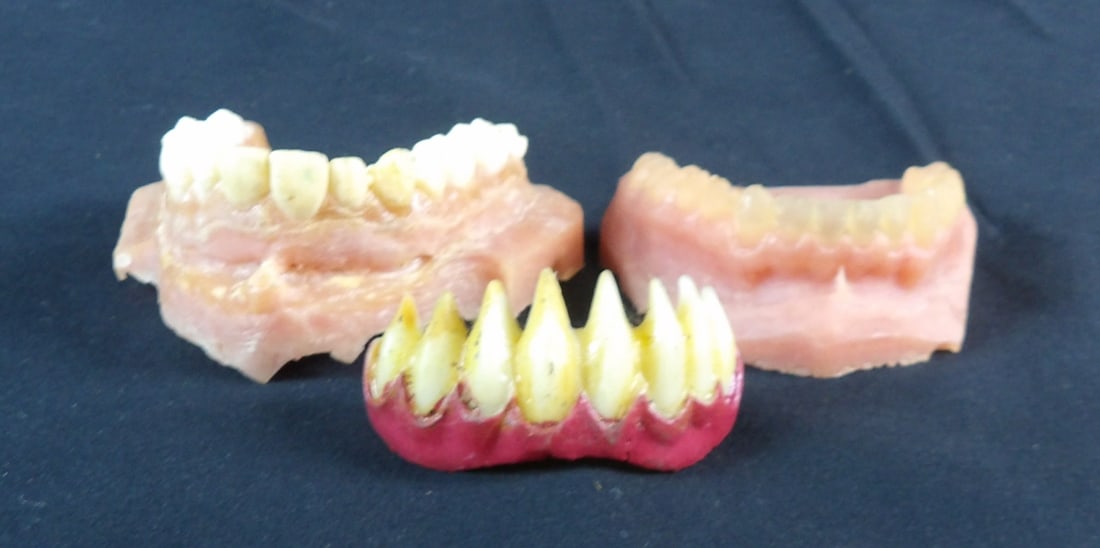 Spiderman 3 Topher Grace Venom Prosthetic Teeth and Mold: Film Used