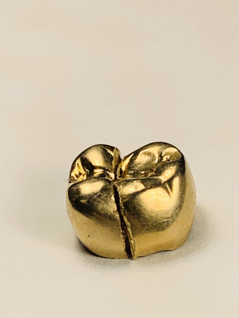 Gold Tooth Cap: split into 2 halves