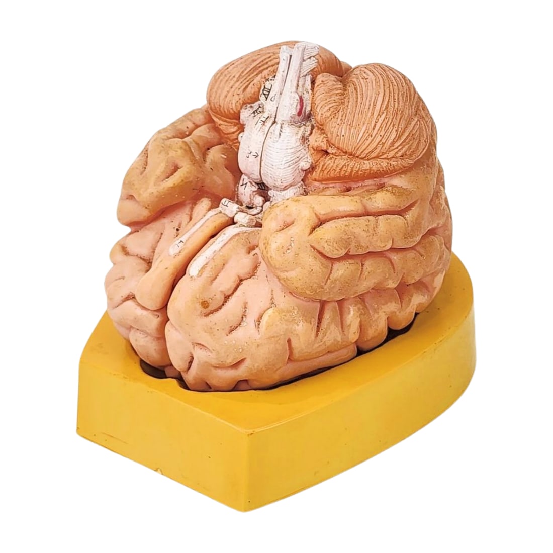 West Germany Doctor's Brain Model Display (1 of 5)