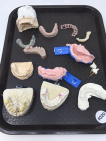 Selection of Teeth Molds