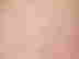 item-104035177=3