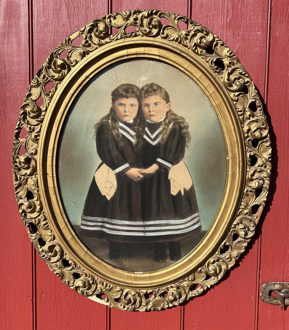 Rare Conjoined Siamese Twin Large Photograph  Syracuse NY Area - Hand Tinted (1 of 12)