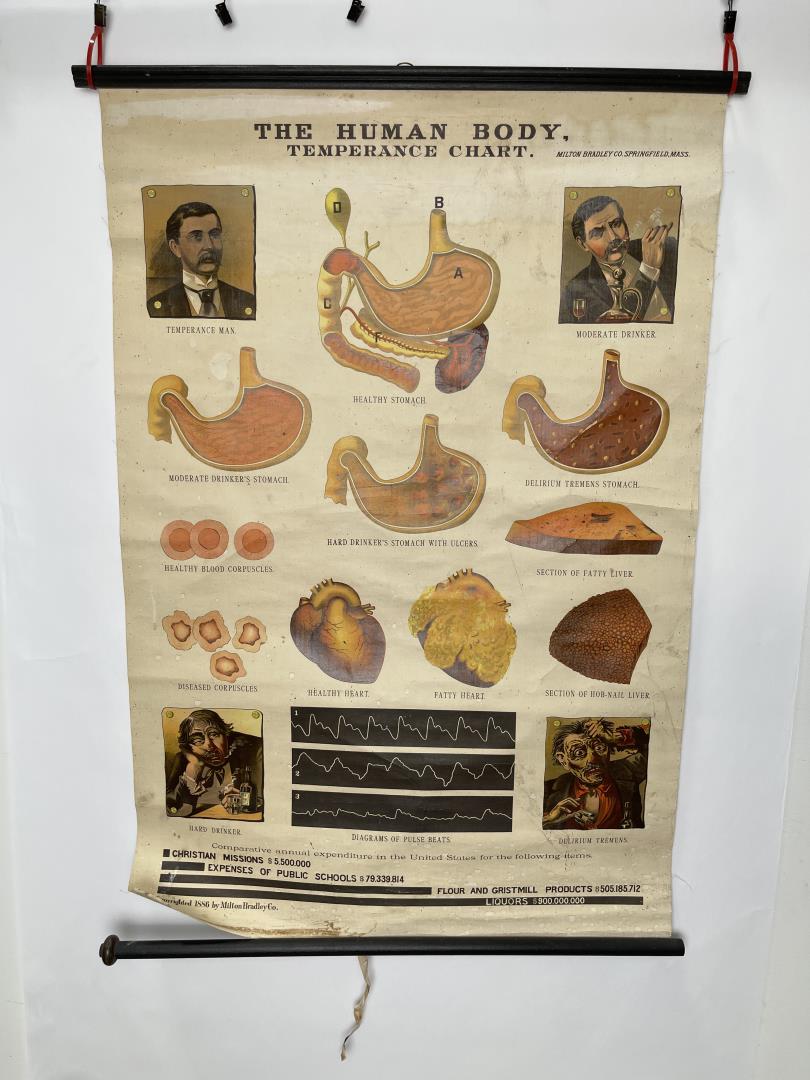 Milton Bradley 1886 Human Body Roll Down Chart (1 of 10)