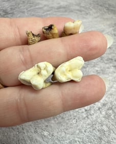 Collection of Human Teeth