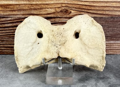 Atlas Bone Vertebrae