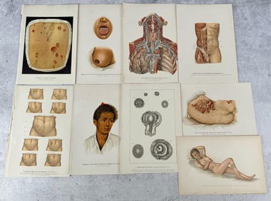 Lithographic Plates Showing Venereal Diseases