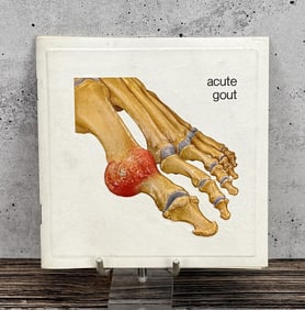 Indocin Acute Gout Booklet
