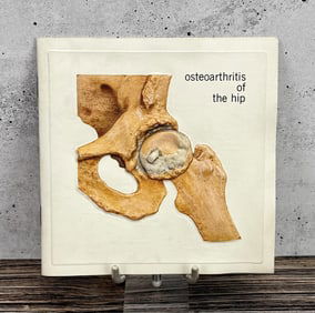Indocin Osteoarthritis of the Hip Booklet