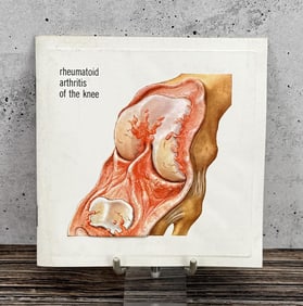 Indocin Rheumatoid Arthritis of the Knee Booklet