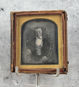 Daguerreotype Photo of Boy With Prosthetic Hand
