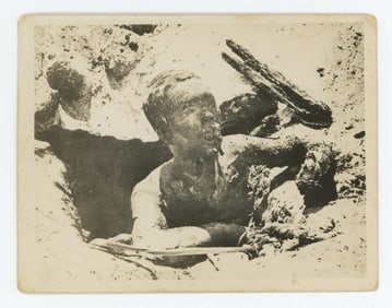 WW2 Marshall Islands Burned Japanese Soldier Photo