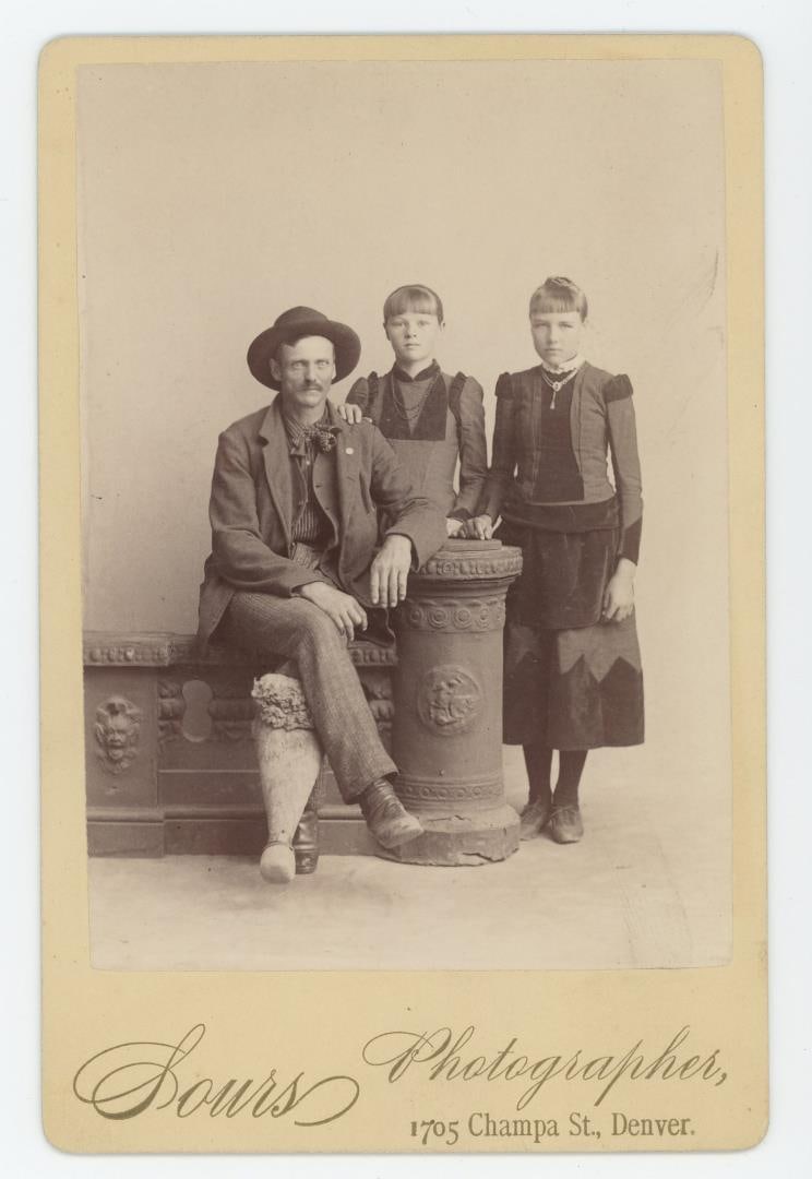 Man with Peg Leg Amputated Leg Cabinet Photo (1 of 3)