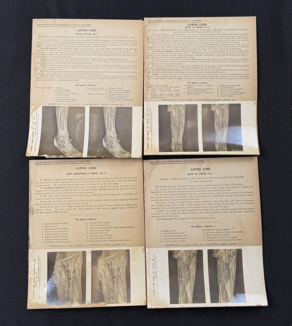 Edinburgh Stereoscopic Atlas of Anatomy (1 of 4)