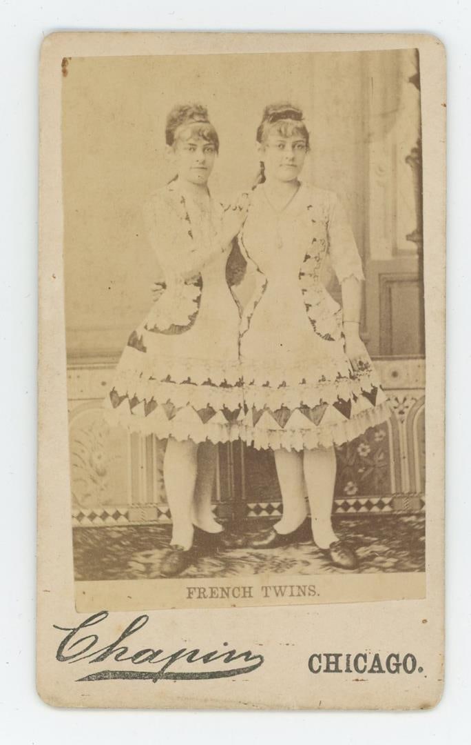 French Twins CDV Chicago Circus Freaks Siamese (1 of 3)