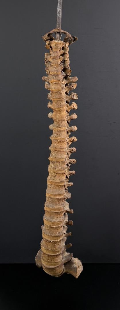 Antique Human Medical Spinal Column: 32 1/4" long on metal rod. No sales to Florida, Georgia, Louisiana, Massachusetts, Minnesota, Missouri, New Hampshire, South Carolina, Texas, Virginia. Anyone attempting to purchase that resides in a 