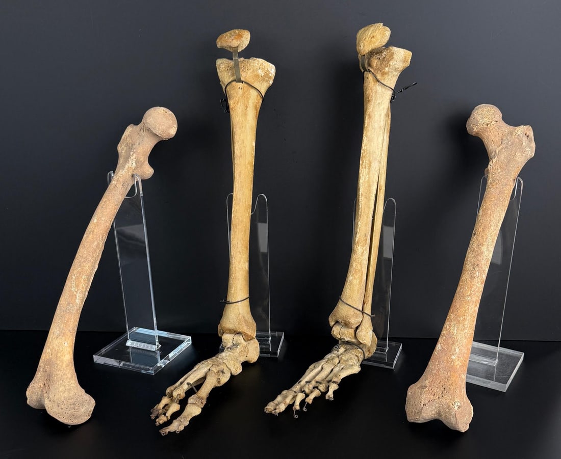 Antique Human Medical Bones Legs and Feet: No sales to Florida, Georgia, Louisiana, Massachusetts, Minnesota, Missouri, New Hampshire, South Carolina, Texas, Virginia. Anyone attempting to purchase that resides in a different state will have t