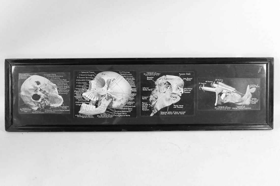 Framed 1919 Dental Chart of Human Skull (1 of 10)