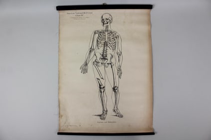 1910 American Red Cross Medical Chart, Fracture Dislocation, Skeleton, 4 of 5