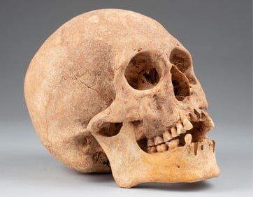 ANTIQUE ANATOMICAL HUMAN SKULL